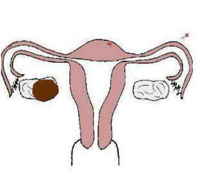 第三代试管婴儿成功率及知名医院推荐与价格指南